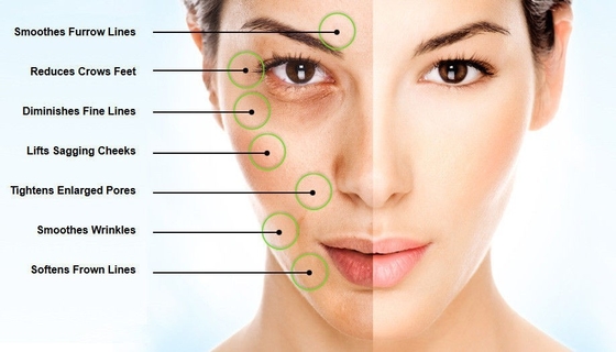 Skincare Hyaluronic Acid Bulk Powder 15000-50000 Dalton Retain Moisture